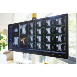 Perlove Medical Electric Digital Intraoperative 3D C-arm X Ray Machine with 1 Year Warranty
