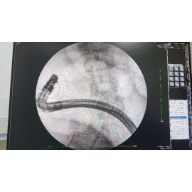 Perlove Medical With Reply Very Quickly Mobile C-arm X-ray Machine Dynamic Flat Panel Detector Professional Medical Devices